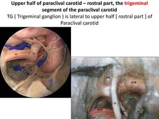 Prof. Marchioni papers of SCC [ Sub
Cocheolar Canal ]
• http://sci-hub.cc/10.1007/s00405-014-2923-8
• http://sci-hub.cc/10.1007/s00276-016-1662-5
 