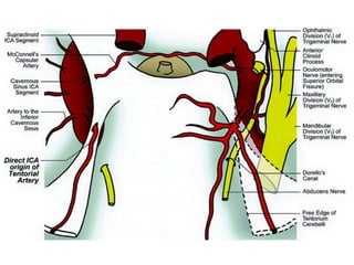 Subcochlear canaliculus type A
 