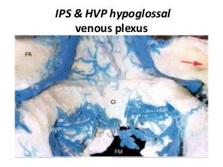 IPS & HVP hypoglossal
venous plexus
 