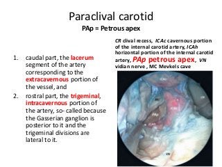 Paraclival carotid
PAp = Petrous apex
1. caudal part, the lacerum
segment of the artery
corresponding to the
extracavernous portion of
the vessel, and
2. rostral part, the trigeminal,
intracavernous portion of
the artery, so- called because
the Gasserian ganglion is
posterior to it and the
trigeminal divisions are
lateral to it.
CR clival recess, ICAc cavernous portion
of the internal carotid artery, ICAh
horizontal portion of the internal carotid
artery, PAp petrous apex, VN
vidian nerve , MC Mevkels cave
 
