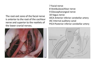 the anterior petrosectomy with preoperative embolization of the inferior
petrosal sinus is a time-conserving approach giving one of the best routes to
reach the ventral brainstem while working in front of the cranial nerves and
preserving hearing.
http://www.worldneurosurgery.org/article/S0090-3019(00)00271-8/fulltext
 