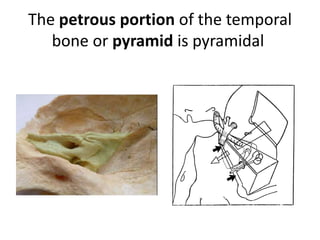 Approaches to petrous apex
LATERAL SKULL BASE
1. From above the labyrinth
a. Middle cranial fossa transpetrous [ =
Trans-apical ] approach
2. From posterior to the labyrinth
a. Retrolabyrinthine transpetrous [ =
Trans-apical ] approach / endoscopic
retrolabyrinthine approach
3. From through the labyrinth
a. Translabyrinthine transpetrous [ =
Trans-apical ] approach
b. Transcochlear transpetrous [ =
Trans-apical ] approach
4. From below the labyrinth
a. INFRA-COCHLEAR approach through
BRACKS MANS TRIANGLE
b. Infralabyrinthine/Infra-otic =
Infratemporal fossa type A transpetrous [
= Trans-apical ] approach
c. POTS
d. Infralabyrinthine/Infra-otic =
Infratemporal fossa type B & C
transpetrous [ = Trans-apical ] approach
ANTERIOR SKULL BASE
1. From anterior to the labyrinth
a. Suprapetrous approach
b. Infrapetrous approach
 