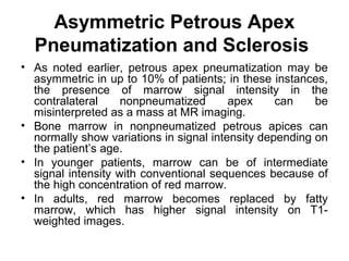 Asymmetric Petrous Apex
Pneumatization and Sclerosis
• As noted earlier, petrous apex pneumatization may be
asymmetric in up to 10% of patients; in these instances,
the presence of marrow signal intensity in the
contralateral nonpneumatized apex can be
misinterpreted as a mass at MR imaging.
• Bone marrow in nonpneumatized petrous apices can
normally show variations in signal intensity depending on
the patient’s age.
• In younger patients, marrow can be of intermediate
signal intensity with conventional sequences because of
the high concentration of red marrow.
• In adults, red marrow becomes replaced by fatty
marrow, which has higher signal intensity on T1-
weighted images.
 
