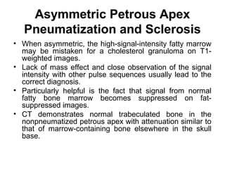 Asymmetric Petrous Apex
Pneumatization and Sclerosis
• When asymmetric, the high-signal-intensity fatty marrow
may be mistaken for a cholesterol granuloma on T1-
weighted images.
• Lack of mass effect and close observation of the signal
intensity with other pulse sequences usually lead to the
correct diagnosis.
• Particularly helpful is the fact that signal from normal
fatty bone marrow becomes suppressed on fat-
suppressed images.
• CT demonstrates normal trabeculated bone in the
nonpneumatized petrous apex with attenuation similar to
that of marrow-containing bone elsewhere in the skull
base.
 