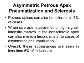 Asymmetric Petrous Apex
Pneumatization and Sclerosis
• Petrous apices can also be sclerotic in 7%
of cases.
• When sclerosis is asymmetric, high-signal-
intensity marrow in the nonsclerotic apex
can also mimic a lesion, similar to cases of
asymmetric pneumatization.
• Overall, these appearances are seen in
less than 5% of individuals.
 