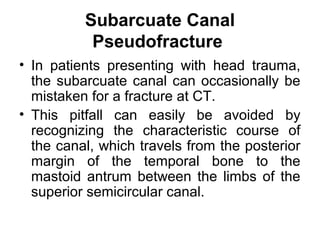 Subarcuate Canal
Pseudofracture
• In patients presenting with head trauma,
the subarcuate canal can occasionally be
mistaken for a fracture at CT.
• This pitfall can easily be avoided by
recognizing the characteristic course of
the canal, which travels from the posterior
margin of the temporal bone to the
mastoid antrum between the limbs of the
superior semicircular canal.
 