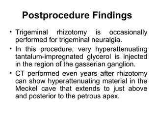 Postprocedure Findings
• Trigeminal rhizotomy is occasionally
performed for trigeminal neuralgia.
• In this procedure, very hyperattenuating
tantalum-impregnated glycerol is injected
in the region of the gasserian ganglion.
• CT performed even years after rhizotomy
can show hyperattenuating material in the
Meckel cave that extends to just above
and posterior to the petrous apex.
 