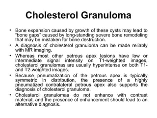 Cholesterol Granuloma
• Bone expansion caused by growth of these cysts may lead to
“bone gaps” caused by long-standing severe bone remodeling
that may be mistaken for bone destruction.
• A diagnosis of cholesterol granuloma can be made reliably
with MR imaging.
• Whereas most other petrous apex lesions have low or
intermediate signal intensity on T1-weighted images,
cholesterol granulomas are usually hyperintense on both T1-
and T2-weighted images.
• Because pneumatization of the petrous apex is typically
symmetric in distribution, the presence of a highly
pneumatized contralateral petrous apex also supports the
diagnosis of cholesterol granuloma.
• Cholesterol granulomas do not enhance with contrast
material, and the presence of enhancement should lead to an
alternative diagnosis.
 