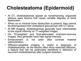 Cholesteatoma (Epidermoid)
• At CT, cholesteatomas appear as nonenhancing, expansile
petrous apex lesions that cause variable degrees of bone
destruction.
• When no or minimal bone destruction is present, they cannot
be distinguished from cholesterol granulomas with CT alone.
• At MR imaging, cholesteatomas generally have intermediate
to low signal intensity on T1-weighted images.
• On T2-weighted and fluid-attenuated inversion-recovery
images, they generally have high signal intensity.
• Enhancement is not seen after contrast material
administration.
• Diffusion-weighted imaging is useful in diagnosis of
cholesteatomas, as the lesions often show restricted diffusion,
a feature that can be particularly beneficial in detection of
recurrent cholesteatomas after surgical resection.
 