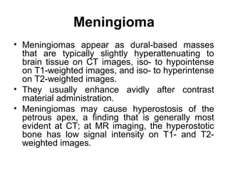 Meningioma
• Meningiomas appear as dural-based masses
that are typically slightly hyperattenuating to
brain tissue on CT images, iso- to hypointense
on T1-weighted images, and iso- to hyperintense
on T2-weighted images.
• They usually enhance avidly after contrast
material administration.
• Meningiomas may cause hyperostosis of the
petrous apex, a finding that is generally most
evident at CT; at MR imaging, the hyperostotic
bone has low signal intensity on T1- and T2-
weighted images.
 