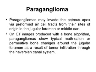 Paraganglioma
• Paragangliomas may invade the petrous apex
via preformed air cell tracts from their sites of
origin in the jugular foramen or middle ear.
• On CT images produced with a bone algorithm,
paragangliomas show typical moth-eaten or
permeative bone changes around the jugular
foramen as a result of tumor infiltration through
the haversian canal system.
 