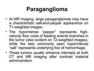 Paraganglioma
• At MR imaging, large paragangliomas may have
a characteristic salt-and-pepper appearance on
T1-weighted images.
• The hypointense “pepper” represents high-
velocity flow voids of feeding arterial branches in
the tumor (also evident on T2-weighted images),
while the less commonly seen hyperintense
“salt” represents underlying foci of hemorrhage.
• These tumors usually enhance intensely at both
CT and MR imaging after contrast material
administration.
 