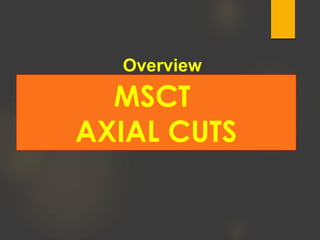 MSCT
AXIAL CUTS
Overview
 