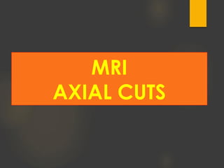 MRI
AXIAL CUTS
 