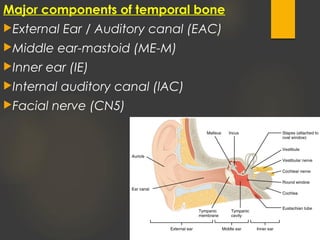 Major components of temporal bone
External Ear / Auditory canal (EAC)
Middle ear-mastoid (ME-M)
Inner ear (IE)
Internal auditory canal (lAC)
Facial nerve (CN5)
 