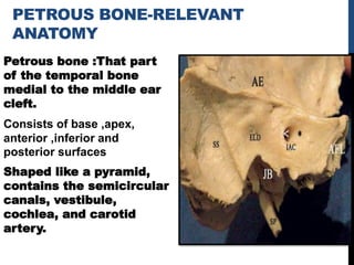 PETROUS BONE-RELEVANT
ANATOMY
Petrous bone :That part
of the temporal bone
medial to the middle ear
cleft.
Consists of base ,apex,
anterior ,inferior and
posterior surfaces
Shaped like a pyramid,
contains the semicircular
canals, vestibule,
cochlea, and carotid
artery.
 