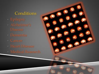 Conditions
• Epilepsy
• Alzheimer’s
Disease
• Dementia
• Cancer
• Heart Disease
• Medical Research
 