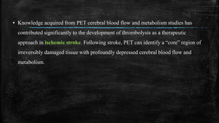 ▪ Knowledge acquired from PET cerebral blood flow and metabolism studies has
contributed significantly to the development of thrombolysis as a therapeutic
approach in ischemic stroke. Following stroke, PET can identify a “core” region of
irreversibly damaged tissue with profoundly depressed cerebral blood flow and
metabolism.
 