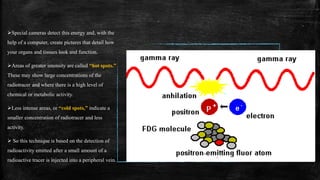 Special cameras detect this energy and, with the
help of a computer, create pictures that detail how
your organs and tissues look and function.
Areas of greater intensity are called “hot spots.”
These may show large concentrations of the
radiotracer and where there is a high level of
chemical or metabolic activity.
Less intense areas, or “cold spots,” indicate a
smaller concentration of radiotracer and less
activity.
 So this technique is based on the detection of
radioactivity emitted after a small amount of a
radioactive tracer is injected into a peripheral vein.
 