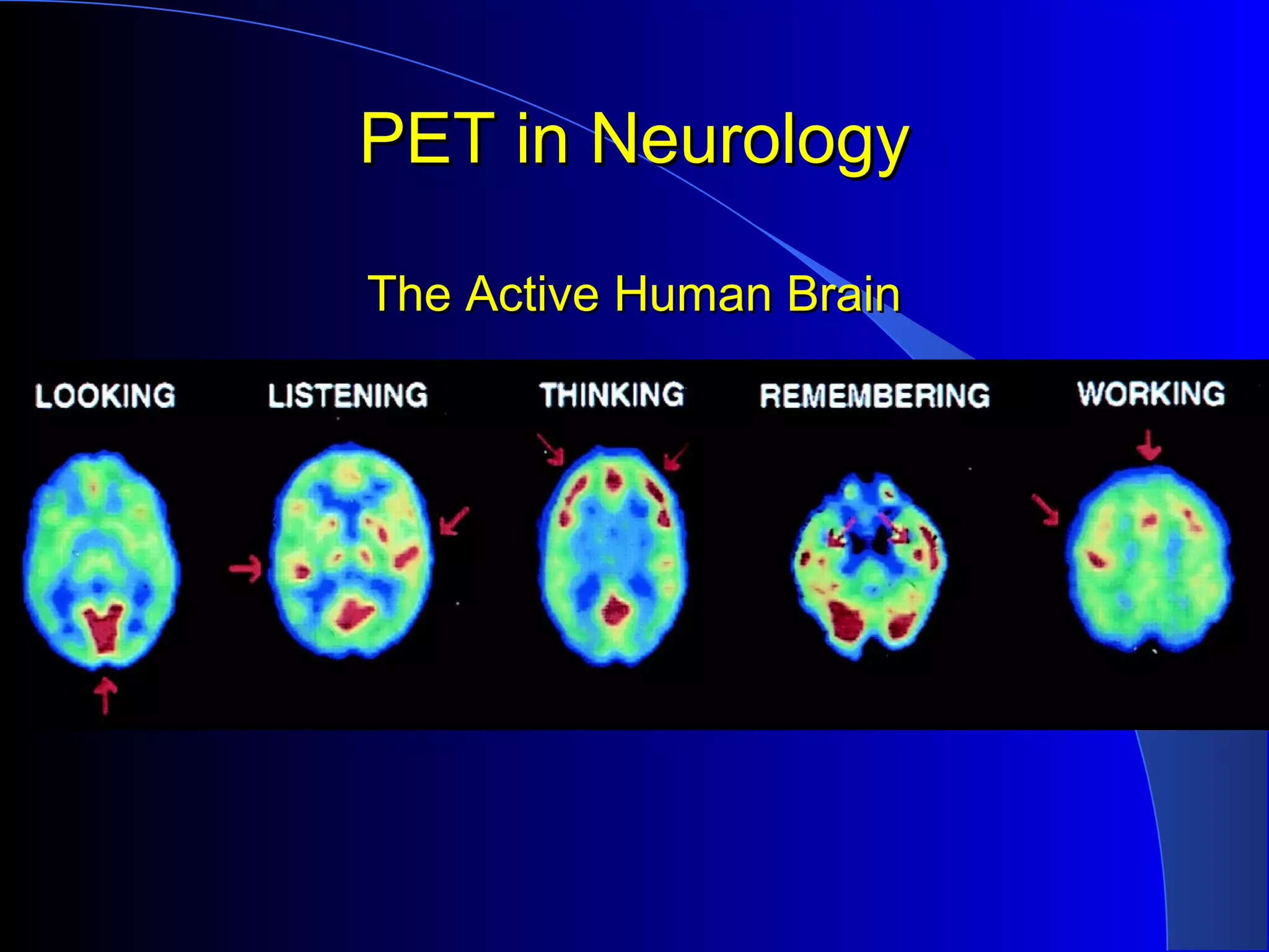PET in NeurologyPET in Neurology
The Active Human BrainThe Active Human Brain
 
