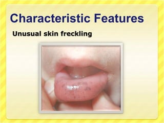 Characteristic Features
Unusual skin freckling