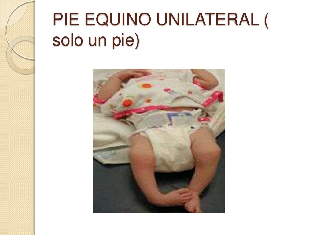 pie equino varo