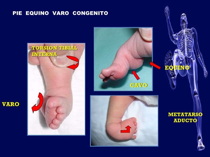 Pevc en el estado portuguesa