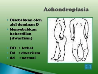 Disebabkan oleh alel dominan D Menyebabkan kekerdilan (dwarfism) DD  :  lethal Dd  : dwarfism dd  : normal 