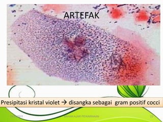 ARTEFAK




Presipitasi kristal violet  disangka sebagai gram positif cocci

   10/25/2011            BAHAN AJAR PEWARNAAN               23
 
