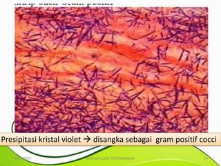 Presipitasi kristal violet  disangka sebagai gram positif cocci

   10/25/2011            BAHAN AJAR PEWARNAAN               24
 
