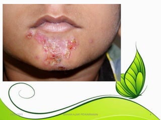 10/25/2011   BAHAN AJAR PEWARNAAN   4
 