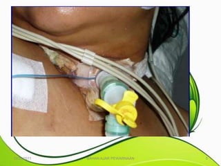 10/25/2011   BAHAN AJAR PEWARNAAN   5
 