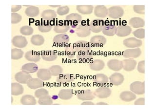 Paludisme et anémie

                 Atelier paludisme
        Institut Pasteur de Madagascar
                    Mars 2005

                  Pr. F.Peyron
            Hôpital de la Croix Rousse
                       Lyon
                      Madagascar
Mars 2005
 