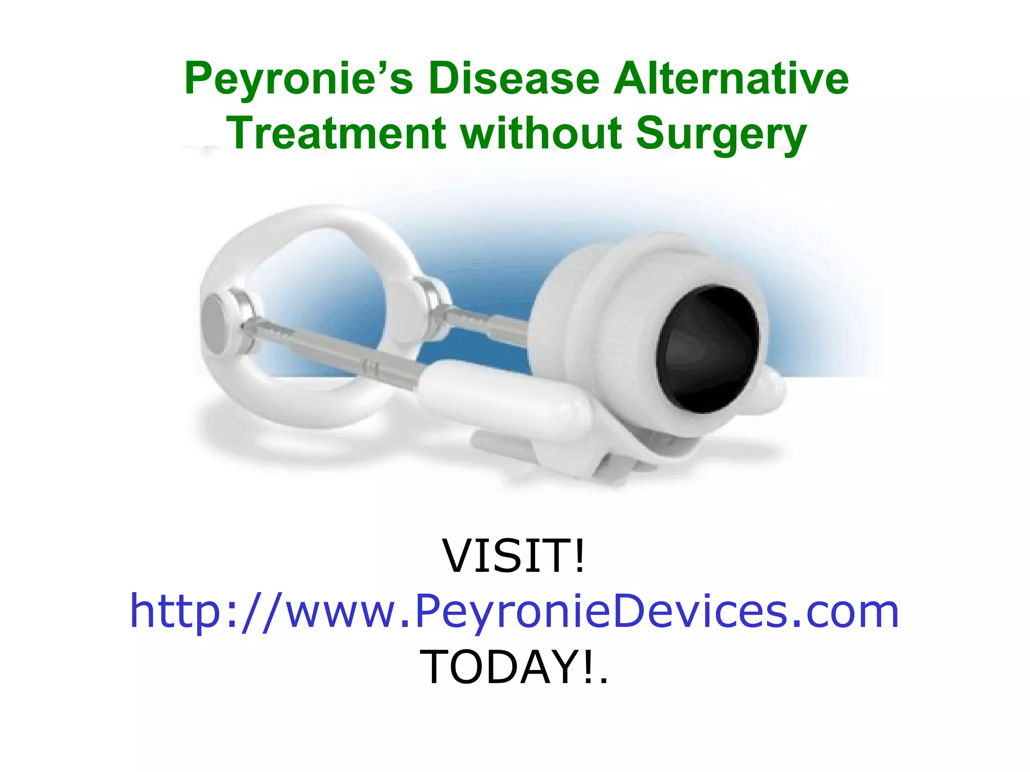 Urgent: Find Your Peyronie'S Disease Icd 10 Code Now - 3ktawkd