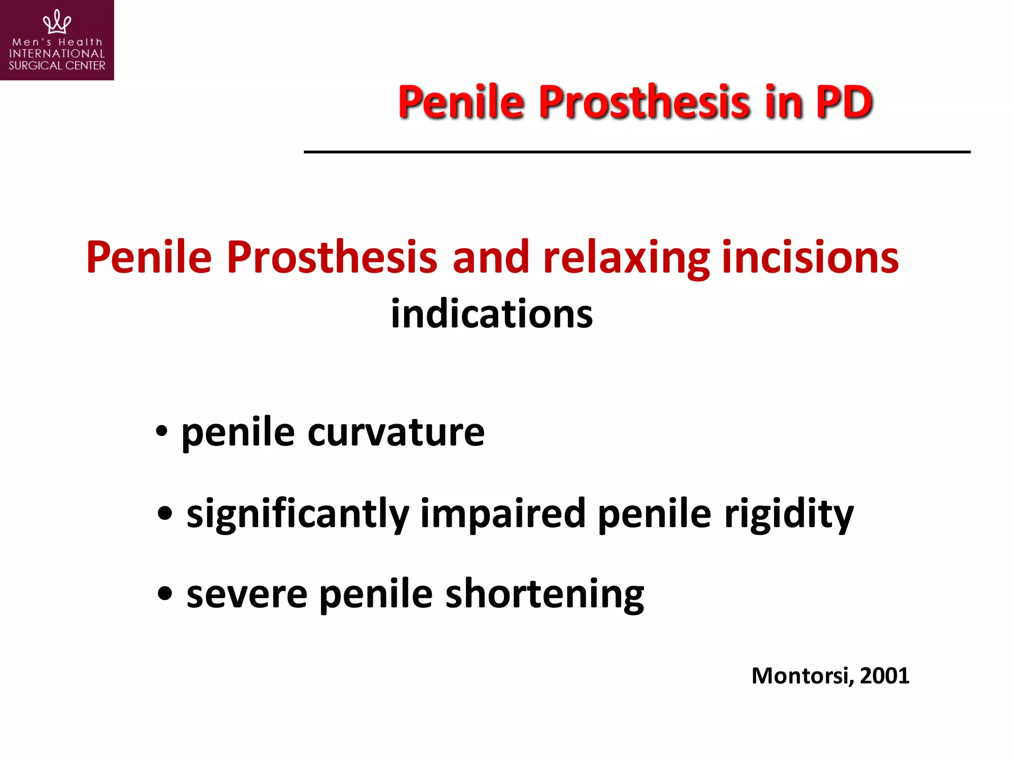 Peyronie's Disease: a tailored surgical procedure for every patient | PDF