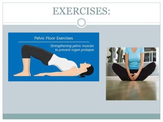 EXERCISES:
 