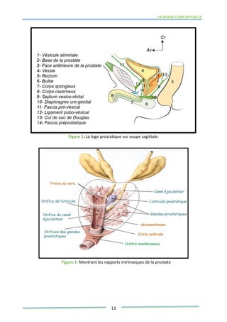 LA PHASE CONCEPTUELLE
13
Figure 1: La loge prostatique sur coupe sagittale.
Figure 2: Montrant les rapports intrinseques de la prostate
 
