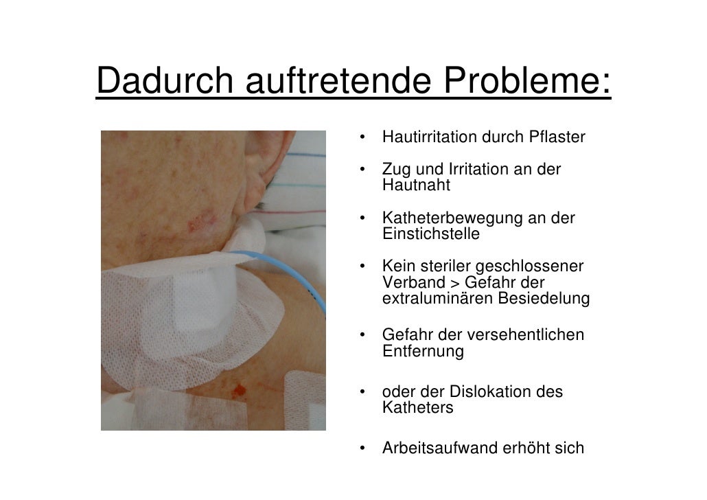 NPK2011: Katheter und Drainagen sicher fixieren – Neue Verbandtechnik