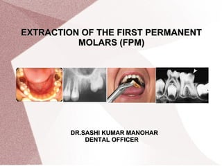 EXTRACTION OF THE FIRST PERMANENTEXTRACTION OF THE FIRST PERMANENT
MOLARS (FPM)MOLARS (FPM)
DR.SASHI KUMAR MANOHARDR.SASHI KUMAR MANOHAR
DENTAL OFFICERDENTAL OFFICER
 