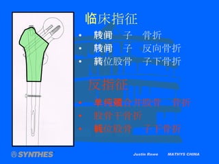 Justin Rowe  MATHYS CHINA 临床指征 股骨转子间骨折 股骨转子间反向骨折 高位股骨转子下骨折 反指征 单纯或合并股骨颈骨折 股骨干骨折 低位股骨转子下骨折 