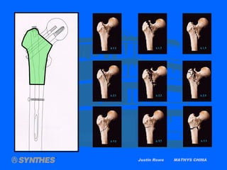 Justin Rowe  MATHYS CHINA 