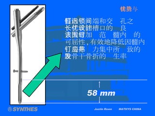 Justin Rowe  MATHYS CHINA 髓内钉远端和交锁孔之间 长杆状凹槽口的优良设计 大大增加该范围髓内钉的 可屈性 , 有效地降低因髓内 钉局部应力集中所导致的 股骨干骨折的发生率 58 mm 特点与优势 