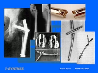 Justin Rowe  MATHYS CHINA 