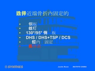 Justin Rowe  MATHYS CHINA 股骨近端骨折内固定的选择 钢板 螺丝钉 130 °/95° 角钢板 DHS / DHS+TSP / DCS 髓内钉固定 假体置换 