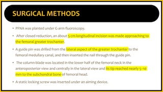 PFN-A versus Hemiarthroplasty.pptx