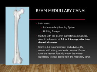 REAM MEDULLARY CANAL
• Instrument:
• Intramedullary Reaming System
• Holding Forceps
• Starting with the 8.5 mm diameter reaming head,
ream to a diameter of 0.5 to 1.5 mm greater than
the nail diameter.
• Ream in 0.5 mm increments and advance the
reamer with steady, moderate pressure. Do not
force the reamer. Partially retract the reamer
repeatedly to clear debris from the medullary canal.
 