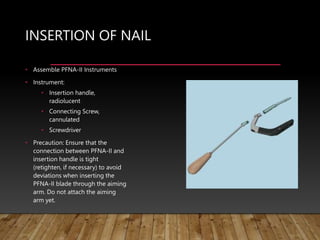INSERTION OF NAIL
• Assemble PFNA-II Instruments
• Instrument:
• Insertion handle,
radiolucent
• Connecting Screw,
cannulated
• Screwdriver
• Precaution: Ensure that the
connection between PFNA-II and
insertion handle is tight
(retighten, if necessary) to avoid
deviations when inserting the
PFNA-II blade through the aiming
arm. Do not attach the aiming
arm yet.
 