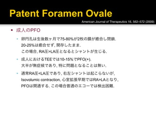 Patent Foramen Ovale
                              American Journal of Therapeutics 16, 562–572 (2009)

   成人のPFO
     卵円孔は生後数ヶ月で75-80%が2枚の膜が癒合し閉鎖.
     20-25%は癒合せず, 開存したまま.
     この場合, RA圧>LA圧となるとシャントが生じる.
     成人におけるTEEでは10-15%でPFO(+).
     大半が無症候であり, 特に問題となることは無い.
     通常RA圧<LA圧であり, 右左シャントは起こらないが,
     Isovolumic contraction, 心室拡張早期ではRA>LAとなり,
     PFOは開通する. この場合普通のエコーでは検出困難.
 