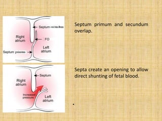 Septum primum and secundum
overlap.
Septa create an opening to allow
direct shunting of fetal blood.
 