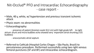 Nit-Occlud® PFO and Intracardiac Echocardiography
- case report -
• Male, 40 y, white, w/ hypertension and previous transient ischemic
attack
• Physic exam: no abnormalities
• Echocardiography:
- presence of patent foramen ovale (0,2 cm) with high grade left to right
atrium shunt and micro bubbles echo showed very important atrial shunting (>25
bubbles)
- aneurysmatic atrial septum
• Referred to CathLab (Hospital Carlos Chagas – São Paulo, Brazil) to
percutaneous procedure. Performed successfully using two right venous
femoral punctures (5F and 8F) and intracardiac echocardiogram.
 